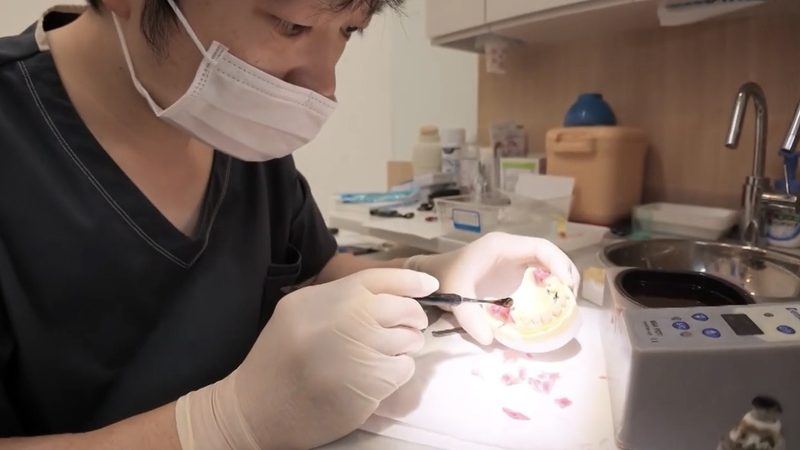 模型上での調整