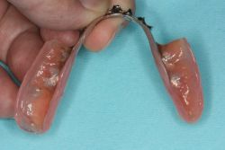 リベース/作業後