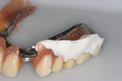 デンチャースペース/作業前