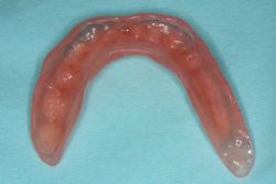 ハイドロ/作業後