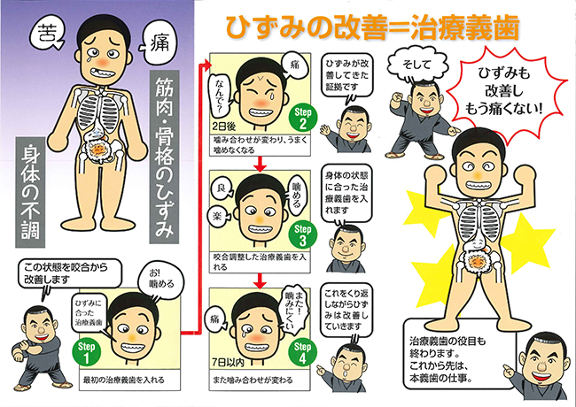 治療義歯によるひずみの改善