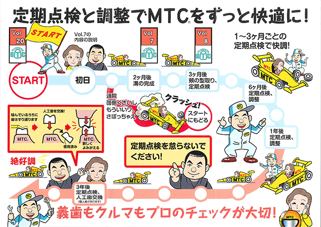 義歯の定期点検