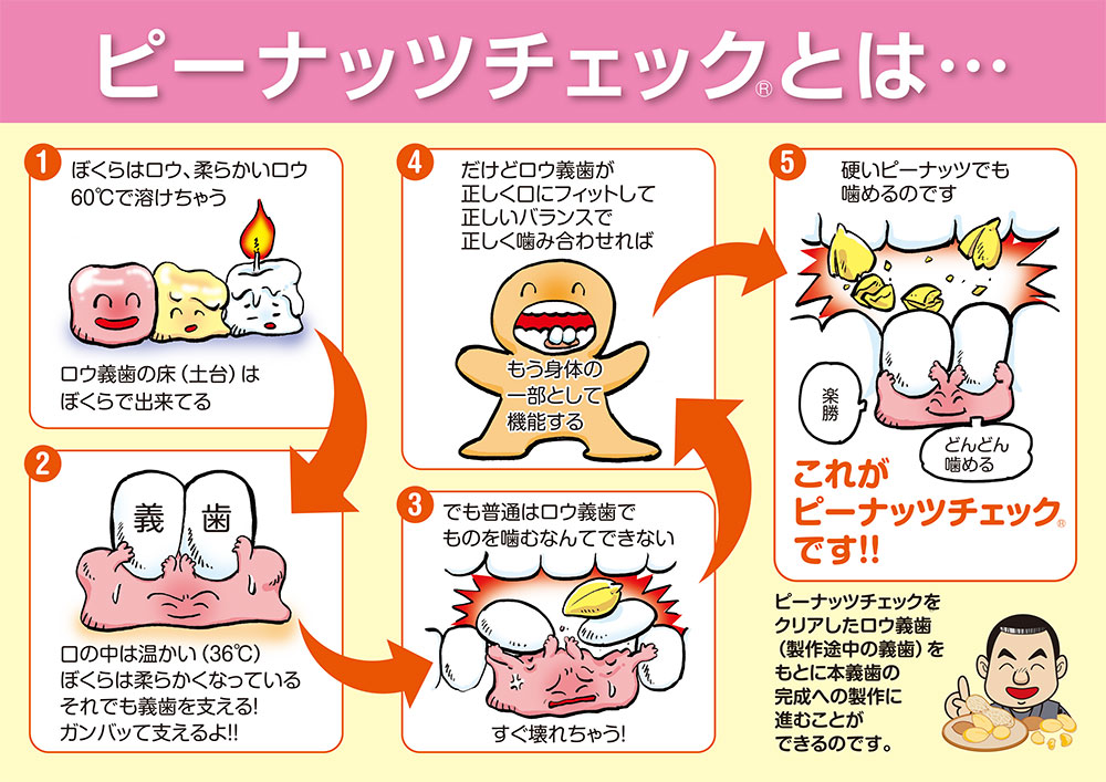 ピーナッツチェック®