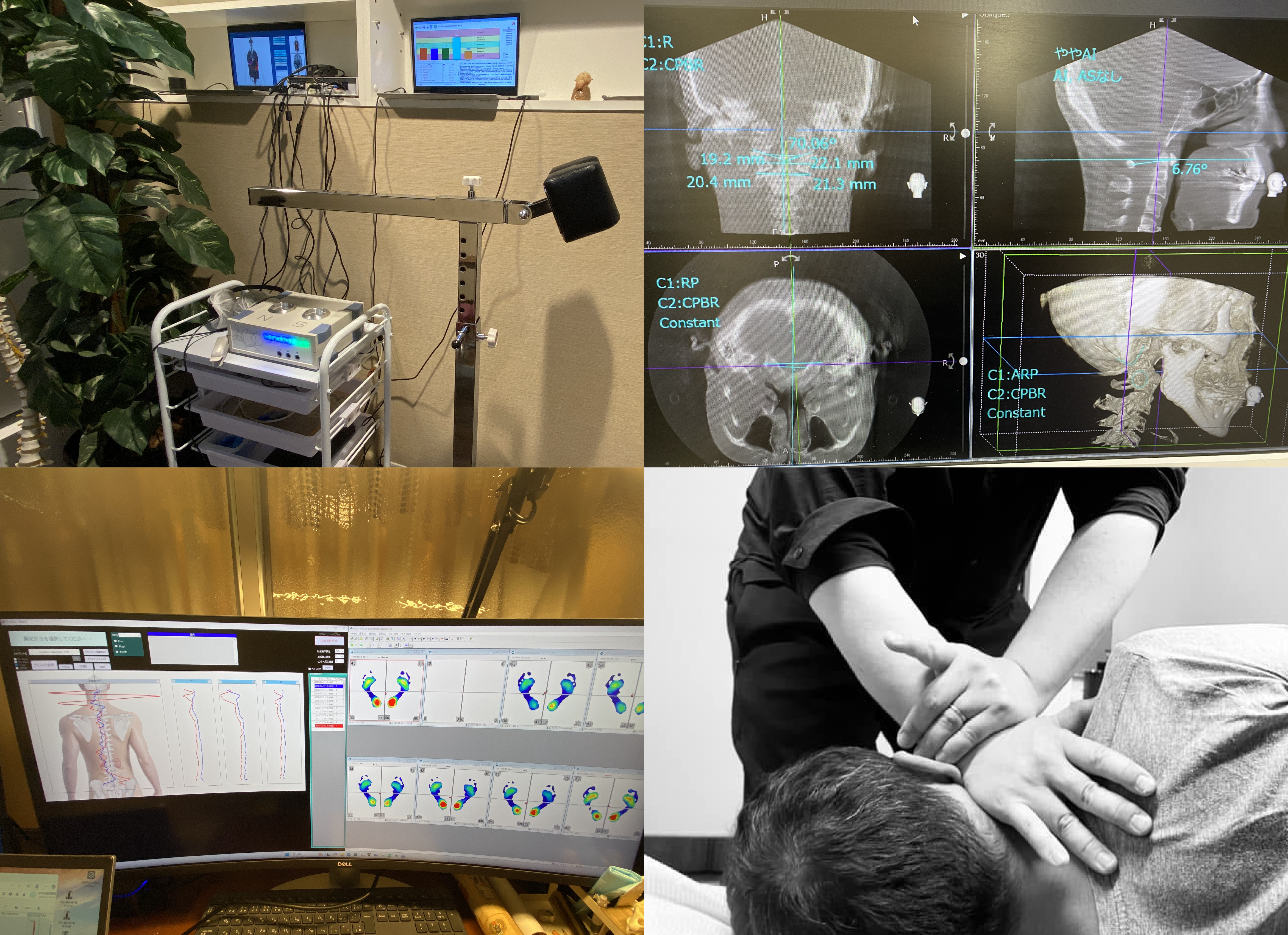 噛み合わせと身体は一体である