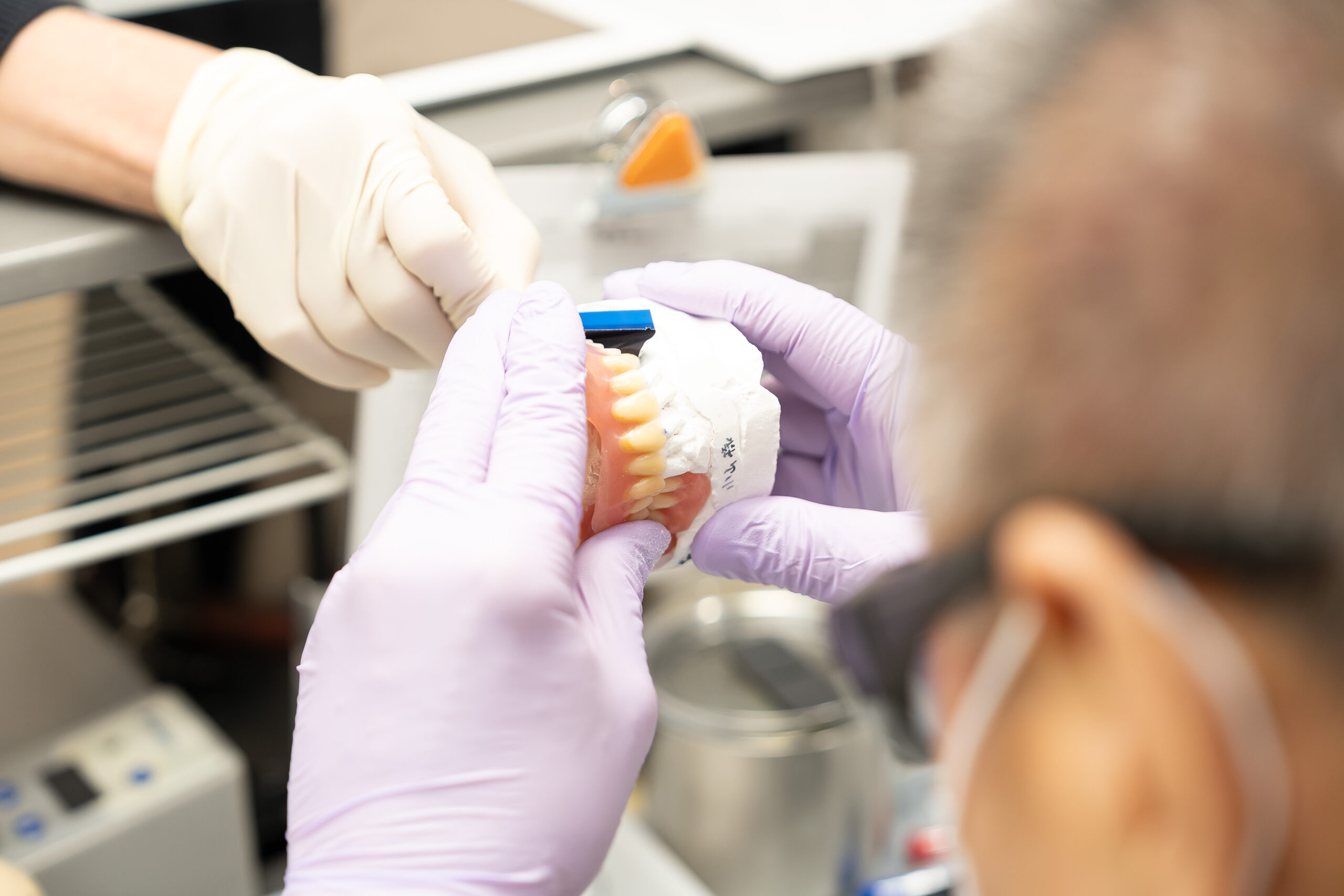 義歯調整の画像